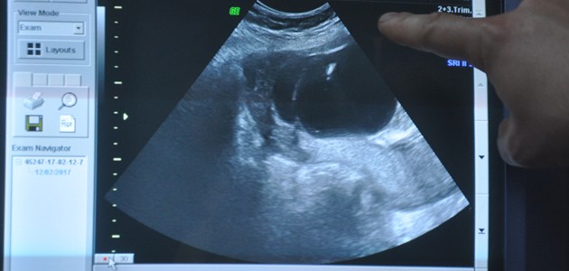 Konya’da anne karnındaki bebeğe ameliyat