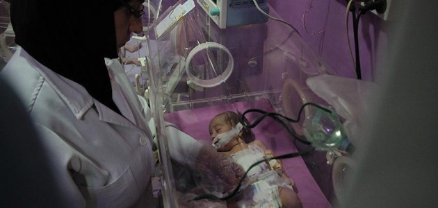 Yer altında ameliyatla kurtarılan bebeği kuşatma öldürdü