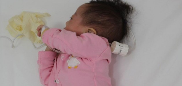 Kayseri’de 3 aylık bebeğin kalbindeki 3 delik kapatıldı