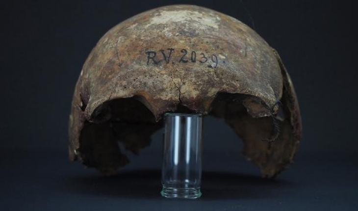 Vebanın bilinen en eski kurbanı: 5 bin 300 yıl önce yaşadı