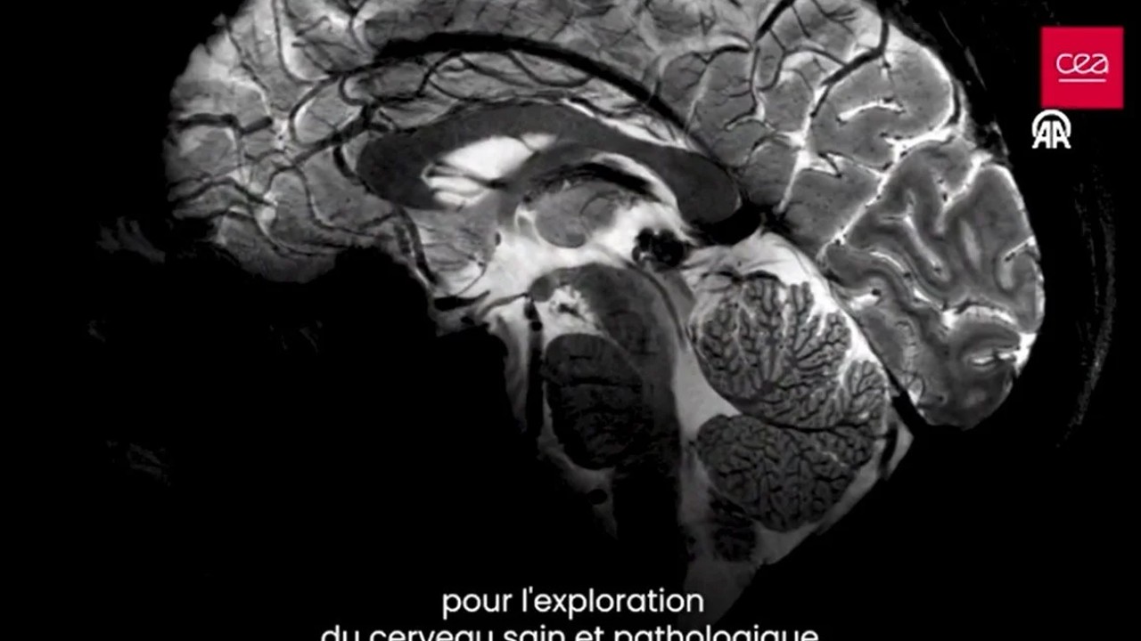 İnsan beyninin en net görüntüsü yayınlandı