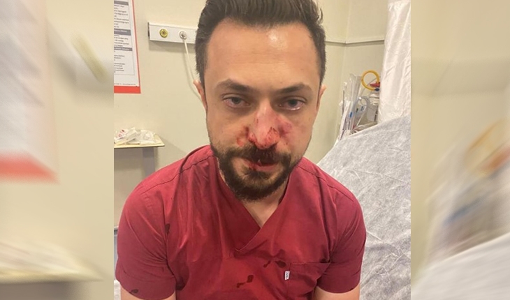 Şanlıurfa’da hasta yakını doktorun burnunu kırdı