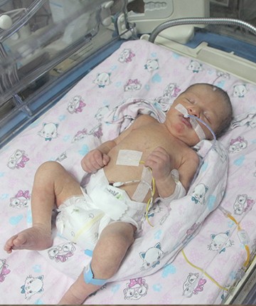  Kazada ölen annesinden sezaryenle alınan mucize bebek, hayati tehlikeyi atlattı 