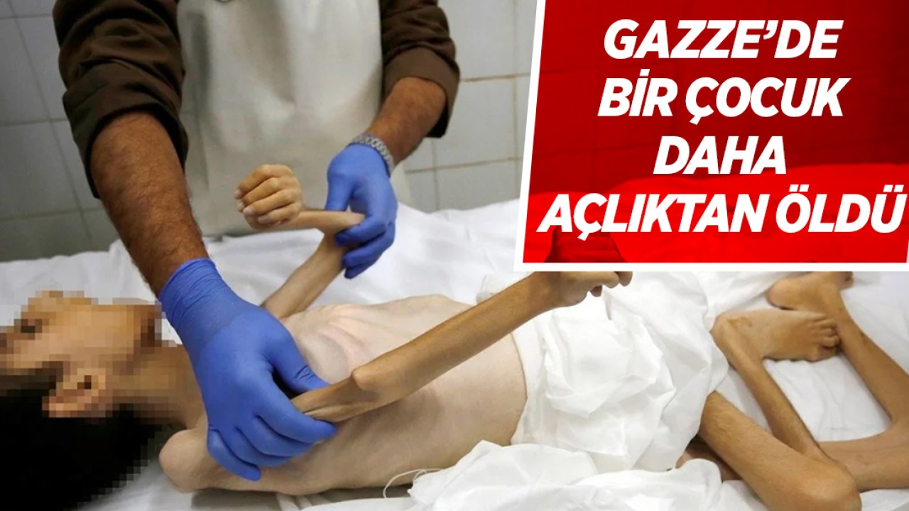 Gazze’de bir çocuk daha açlıktan öldü