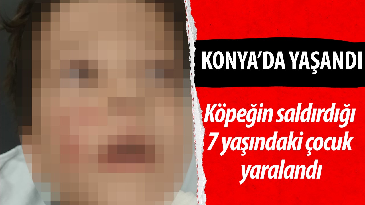 Konya’da köpeğin saldırdığı 7 yaşındaki  çocuk yaralandı