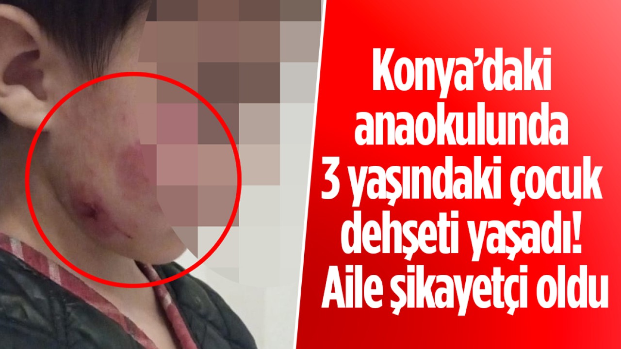 Konya’daki anaokulunda 3 yaşındaki çocuk dehşeti yaşadı... O anlar kamerada! Aile şikayetçi oldu