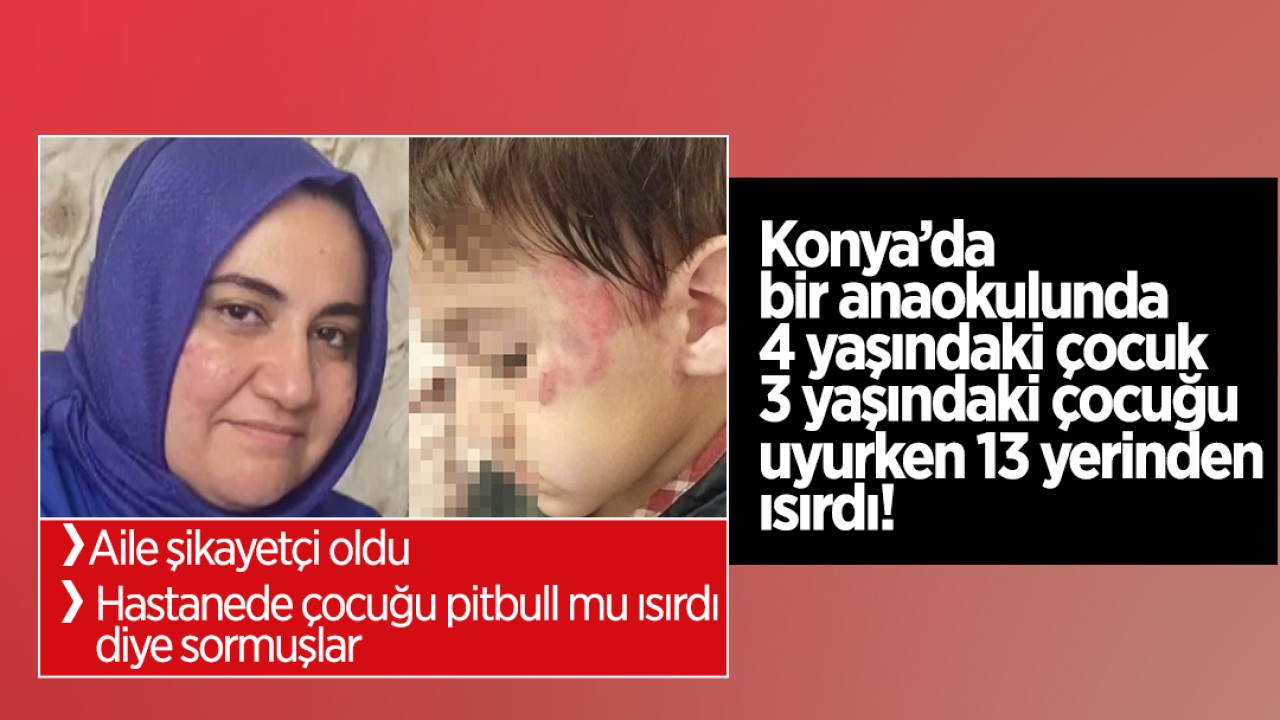 Konya'da bir anaokulunda 4 yaşındaki çocuk 3 yaşındaki çocuğu uyurken 13 yerinden ısırdı; Hastanede 'Çocuğu pitbull mu ısırdı' diye sormuşlar!