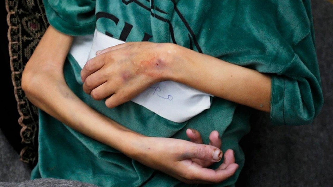 İsrail saldırıları altındaki Gazze’de bir haftada 4 çocuk daha “açlıktan“ öldü