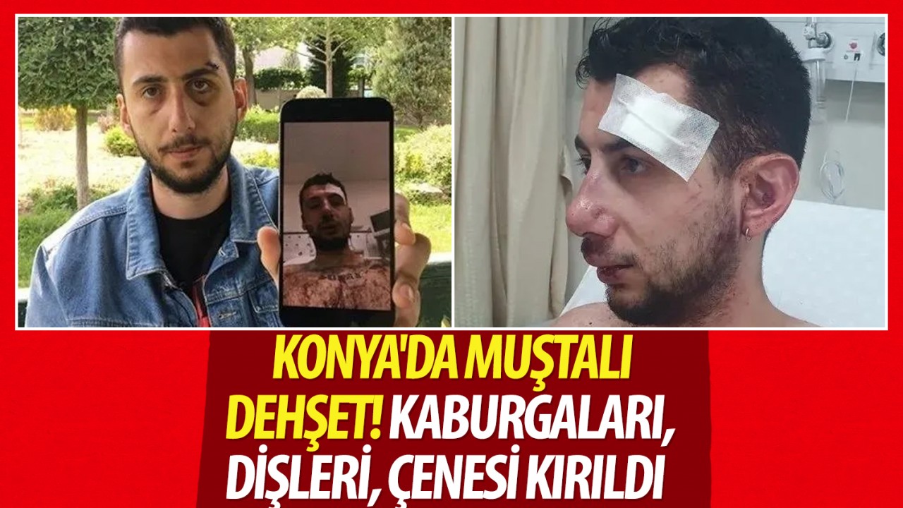 Konya’da muştalı dehşet! Kaburgaları, dişleri, çenesi kırıldı... Saldırgana “iyi hal“ indirimi