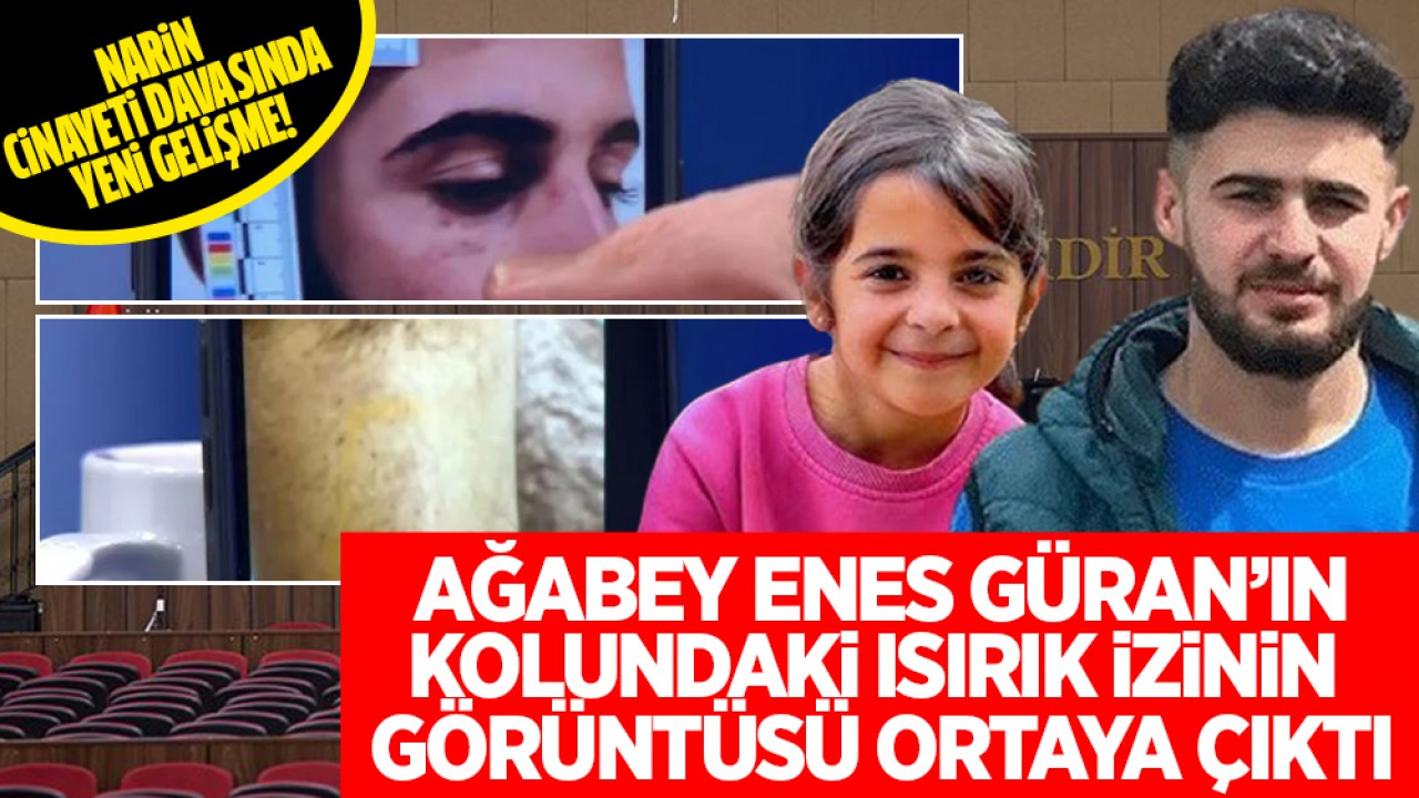 Narin Güran cinayeti davasında yeni gelişme! Ağabey Enes Güran'ın kolundaki ısırık izinin görüntüsü ortaya çıktı