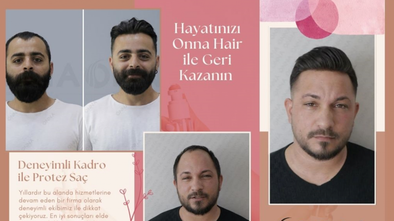 Hayatınızı Onna Hair ile Geri Kazanın