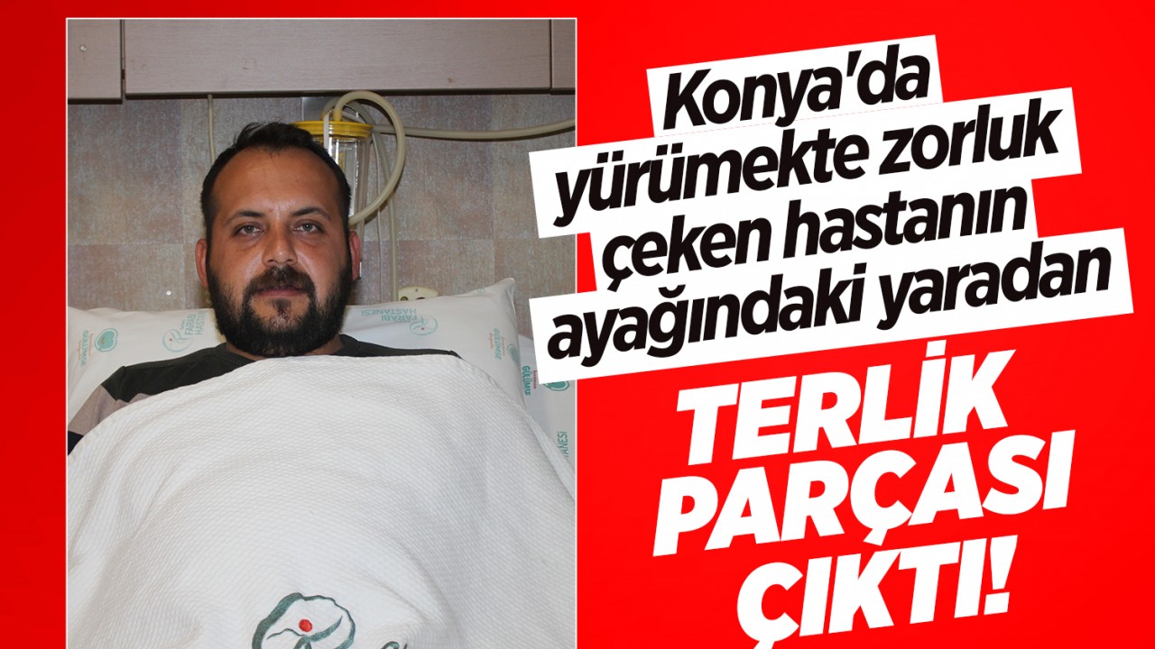 Konya’da yürümekte zorluk çeken hastanın ayağındaki yaradan terlik parçası çıktı